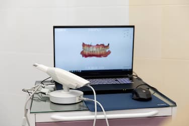 Преимущества изготовления коронок с помощью интраорального  3D-сканера